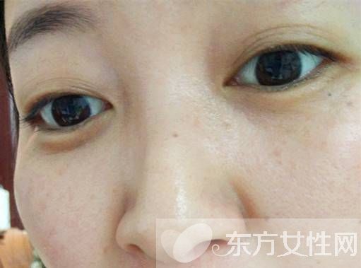 臉部色斑形成的原因 教你在家自制祛斑面膜