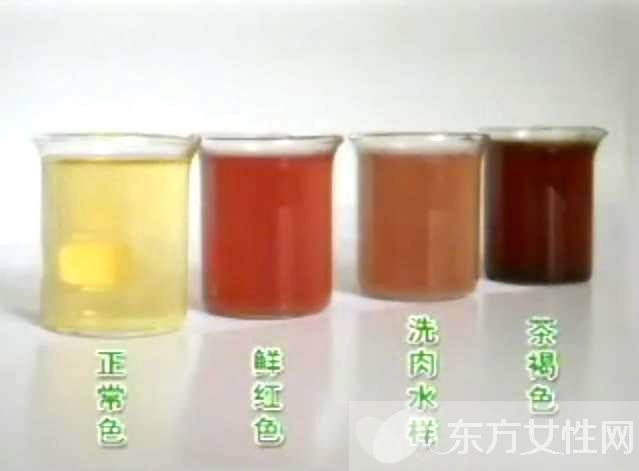 女人小便很黃怎么回事 怎么從尿的顏色看健康