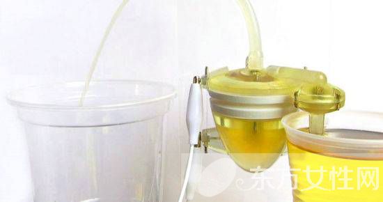 女人小便很黃怎么回事 小便后該用紙擦嗎