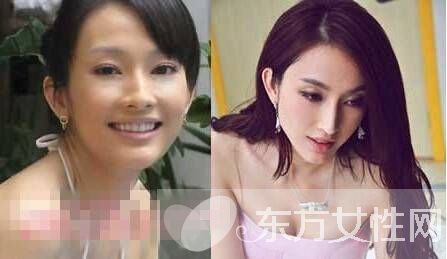 張儷王陽(yáng)明分手真相 張麗個(gè)人資料整容照片遭扒