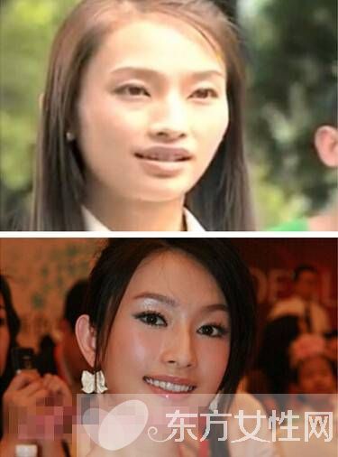 張儷王陽(yáng)明分手真相 張麗個(gè)人資料整容照片遭扒