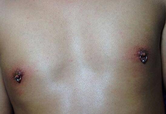 張靚穎打乳環(huán)囧照曝光 打乳環(huán)到底是個什么鬼