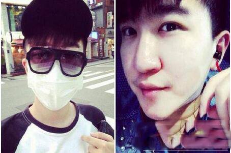 張大大身高是多少 張大大惡心炒作整容照遭扒