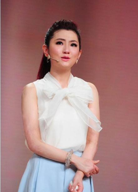 selina離婚真相大揭秘 selina燒傷前后照片對比