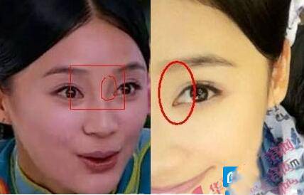 揭袁姍姍整容前后照片 與楊冪美貌事業(yè)大PK