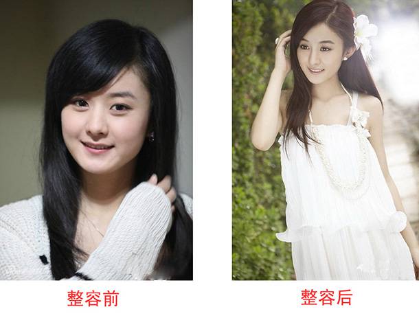 趙麗穎整容了嗎 趙麗穎的男朋友是誰(shuí)