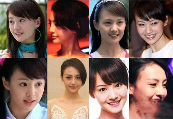 鄭爽整容前后對(duì)比照片 揭與張翰分手的真正原因