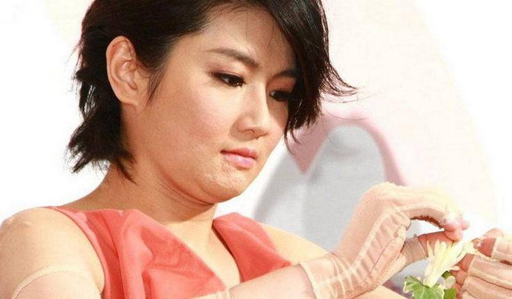 selina離婚真相大揭秘 selina燒傷前后照片對比