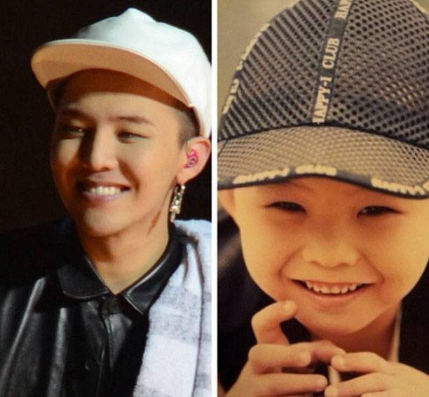 崔勝賢整容前后照片對比 Bigbang成員整容