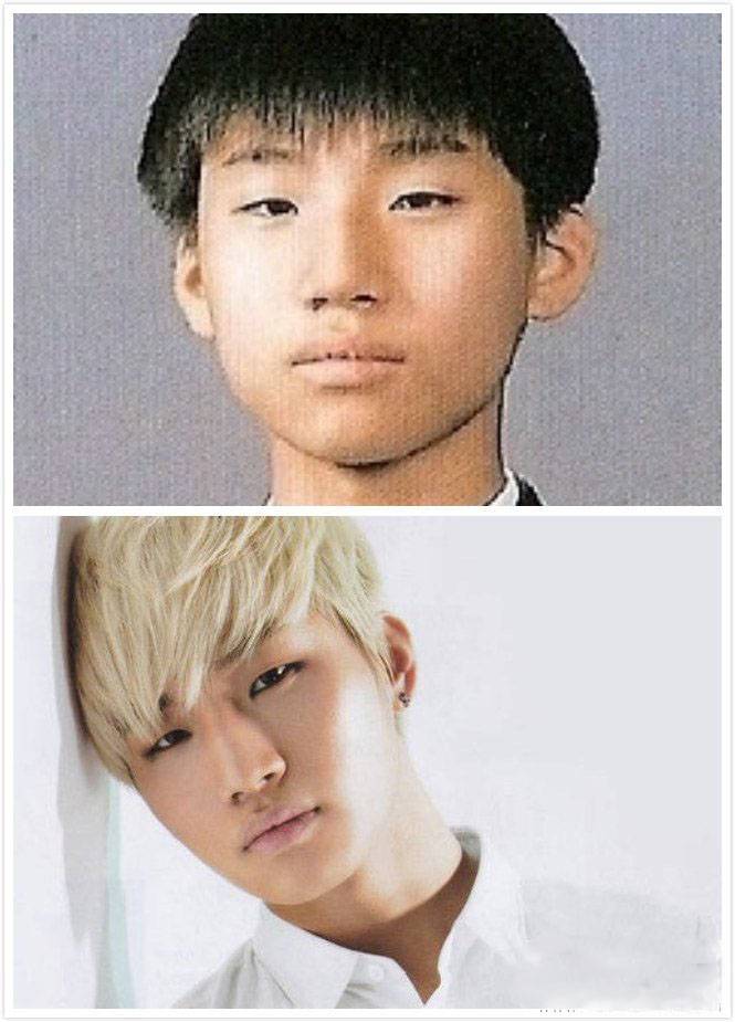 崔勝賢整容前后照片對(duì)比 Bigbang成員整容