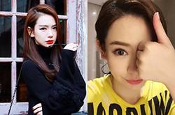 戚薇日本拍戲受傷 需做面部縫針手術(shù)