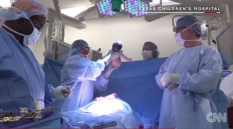胎兒23周被取出子宮 手術后放回32周健康出生