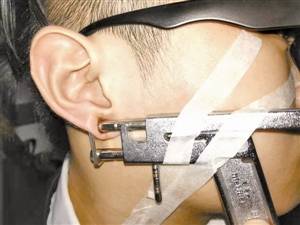 男子打耳洞卻遭耳釘槍夾住 男子稱留下陰影不敢打了