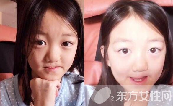 李亞鵬女兒李嫣近照曝光 深扒李嫣兔唇真相