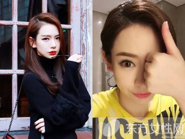 戚薇日本拍戲受傷 需做面部縫針手術