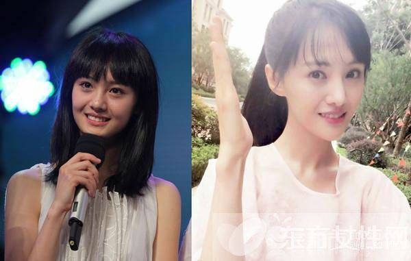 鄭爽整容前后對(duì)比照 網(wǎng)友直呼鄭爽太傻為張翰整容