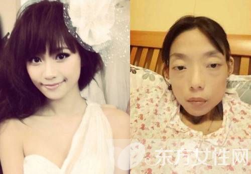 郭永淳迎娶楊愛瑾 前妻卻重病暴瘦