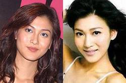 李彩樺個(gè)人資料曝光 李彩樺整容前后對比照