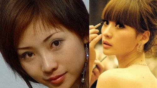 柳巖整容前后對(duì)比照 柳巖承認(rèn)整容打瘦臉針