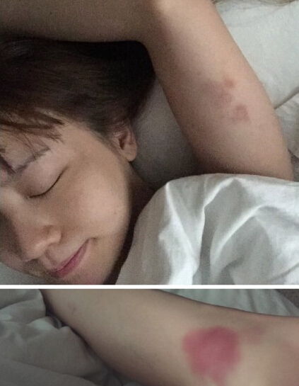 趙本山有哪些徒弟 趙本山徒弟陳美心受傷