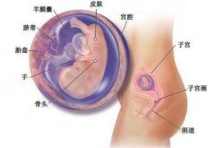 胎兒宮內發(fā)育遲緩怎么辦 這些方面一定要注意