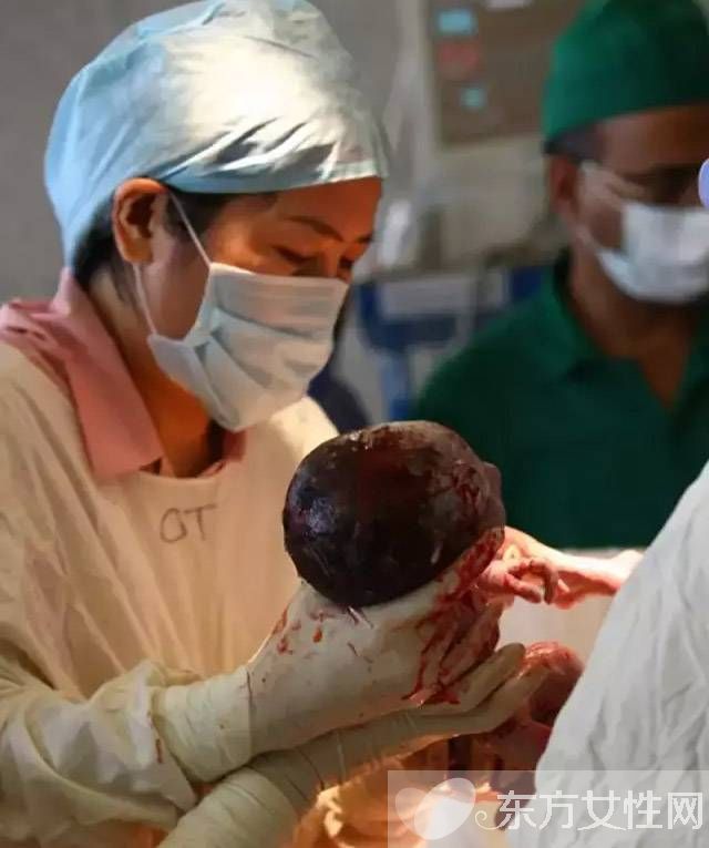 產婦分娩中都有哪些意外發(fā)生 這些應急措施要牢記