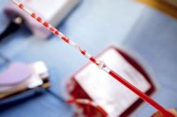 臍帶血有必要保存嗎 臍帶血別扔可以救命的