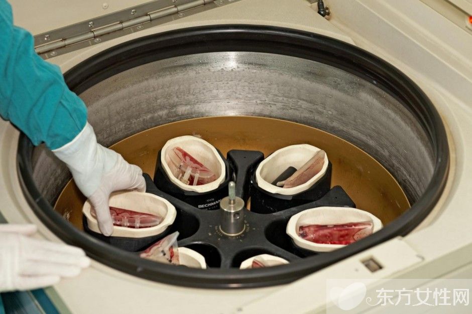 臍帶血有必要保存嗎 臍帶血別扔可以救命的