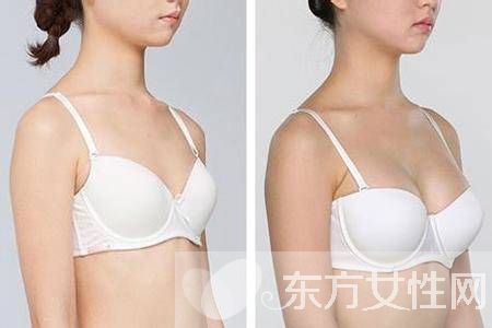 產后胸部下垂怎么辦 只需六招便能重新力挺起來