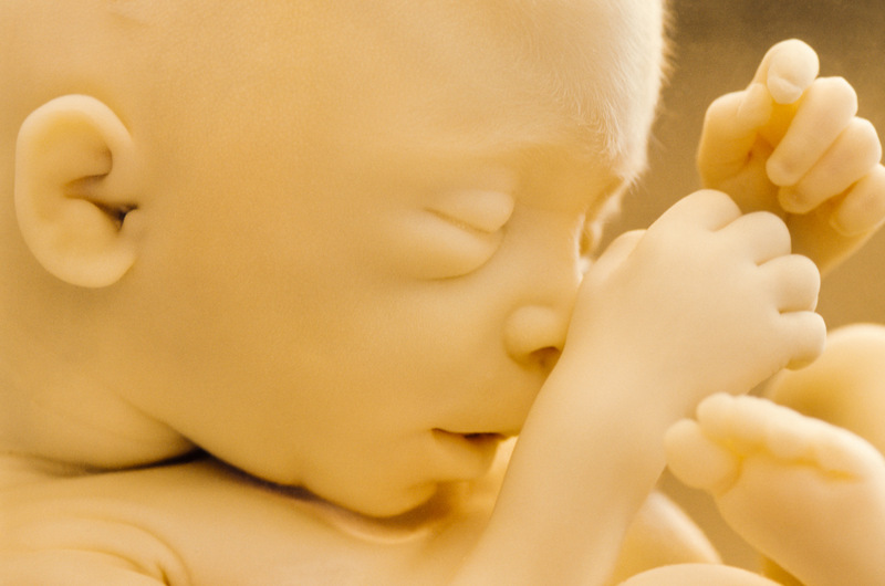 臍帶繞頸一周怎么辦 如何預防胎兒臍帶繞頸