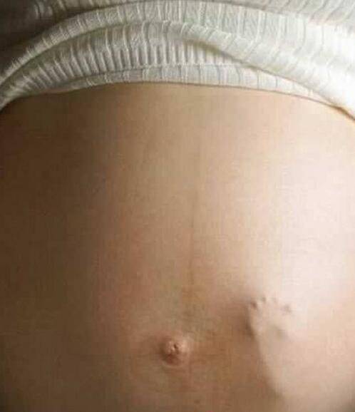 胎動頻繁要注意 當心寶寶會 缺氧