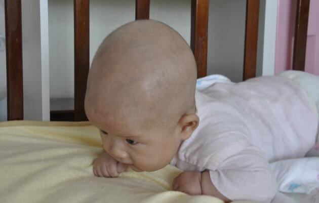 為什么嬰兒要練習(xí)抬頭 訓(xùn)練抬頭需注意