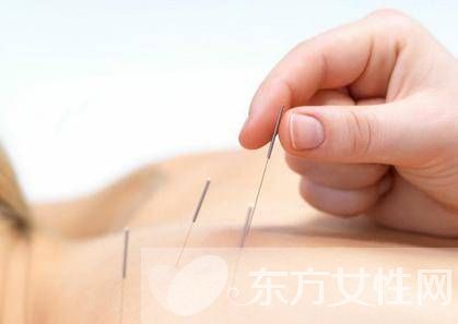 針灸減肥誤區(qū)須知 針灸減肥的副作用有哪些