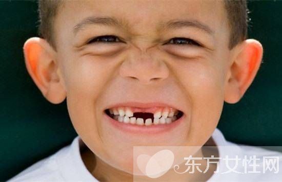兒童換牙順序圖 兒童換牙一定要注意這些方面
