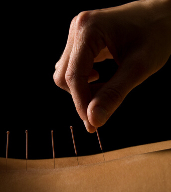 針灸減肥 針灸減肥十大常見問題