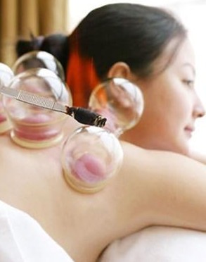 拔罐減肥方法 拔罐減肥的禁忌及注意事項(xiàng)