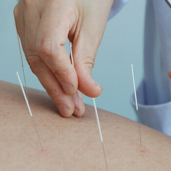 如何進(jìn)行針灸 注意針灸減肥的四大誤區(qū)