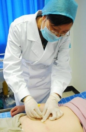 穴位埋線減肥 埋線減肥的注意事項