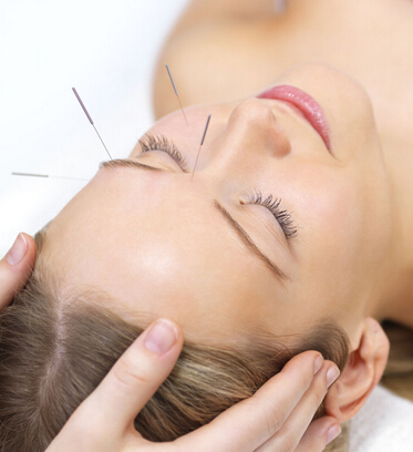 針灸的減肥原理 調(diào)整身體代謝功能