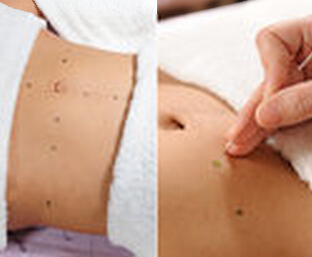 埋線減肥初試者 需嚴守4大注意事項