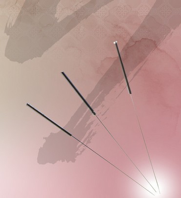 中醫(yī)健康減肥 常用5種的針灸減肥方法