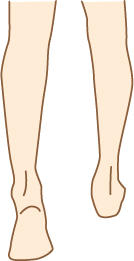 減肥跟體溫有關(guān)系 輕松減肥告別下半身肥胖