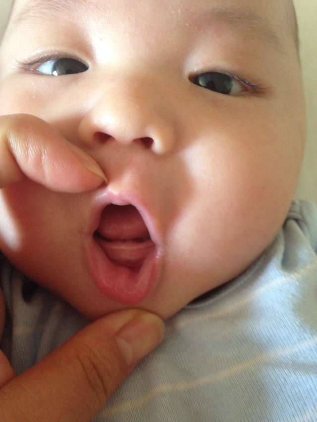 寶寶長牙順序很關(guān)鍵 家長千萬別錯過