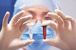 什么是流腦疫苗 流腦疫苗的接種注意事項