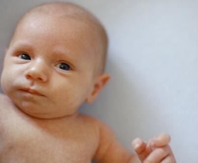 核黃疸早期四大癥狀 核黃疸的后遺癥有哪些