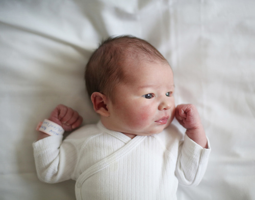 嬰兒臉上起小紅疙瘩 當(dāng)心是過敏惹的禍