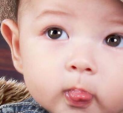 寶寶缺鋅的癥狀是怎樣的 寶寶會有哪些表現(xiàn)