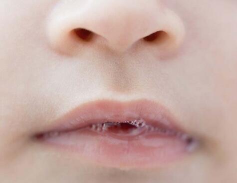 寶寶肺炎早期癥狀有哪些 寶寶咳嗽需當心