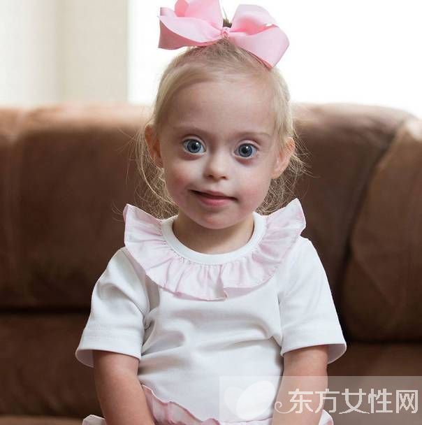 唐氏綜合癥是什么 如何有效預(yù)防寶寶唐氏綜合癥
