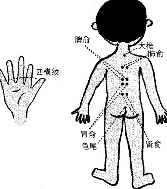 小兒腹瀉、厭食該怎么辦 選擇小兒推拿穴位養(yǎng)生